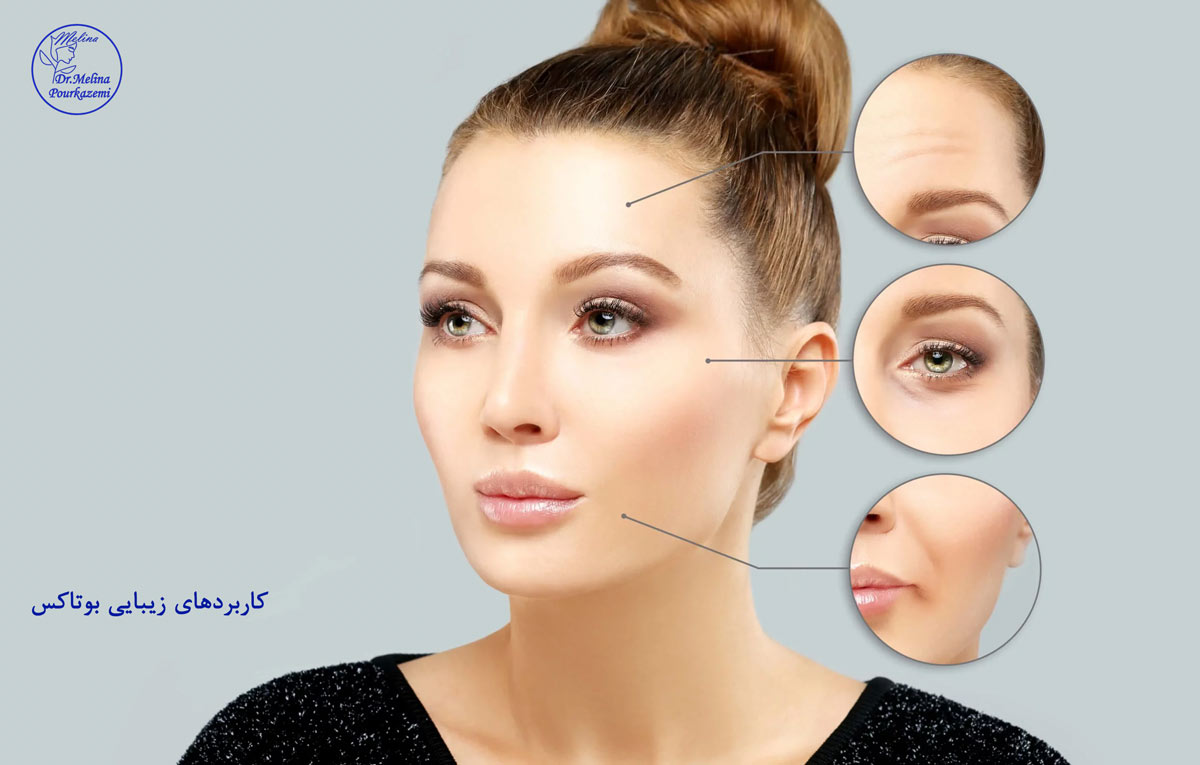 تزری بوتاکس ملینا بیوتی
