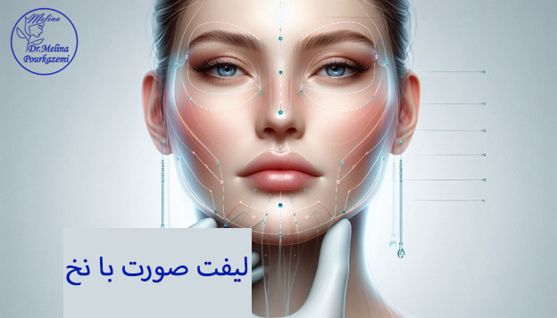  لیفت-صورت- ملینا پورکاظمی